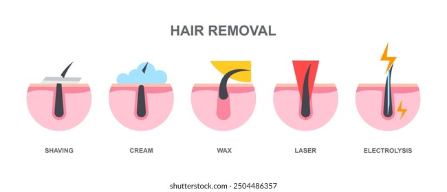 Procedure hair removal, main methods of hair removal: shaving, cream, wax, laser, electrolysis.