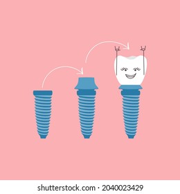 Procedure for implanting in funny scheme