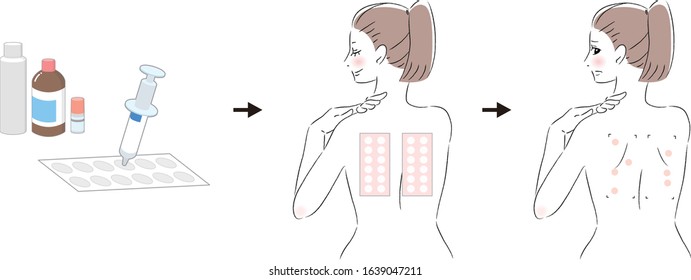 
Procedure For Women To Take A Patch Test