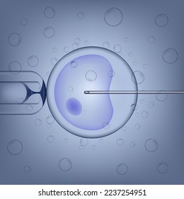 The process of artificial insemination. The sperm is artificially injected into the egg. Medical poster. Vector illustration.