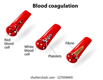 Process Of Blood Coagulation. Vector