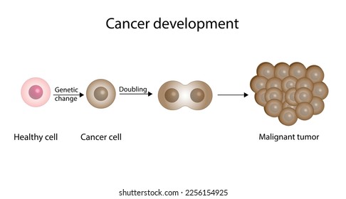 Proceso de desarrollo de células cancerígenas. Desarrollo de la enfermedad del cáncer. Tumor maligno. Biología médica, ilustración científica vectorial.
