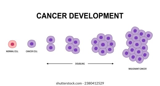 Process of cancer cell development in flat design on white background.