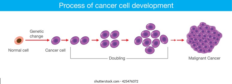 Process of cancer cell development. Medical illustration.
