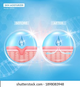 Process of getting skin younger with help of Moisturizing before and after skin solutions ad, orange collagen serum drop with cosmetic advertising background. Vector EPS10