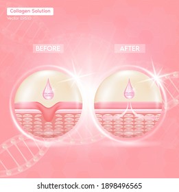 Process of getting skin younger with help of Collagen Solution before and after skin solutions ad, orange collagen serum drop with cosmetic advertising background. Vector EPS10