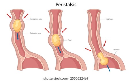 processo de peristaltismo no esôfago, ilustrando contrações musculares e movimento alimentar em direção à ilustração vetorial esquemático desenhado à mão em diagrama estomacal. Ilustração educacional de ciências médicas