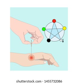  The process of treatment by a reflexologist. According to the system of traditional Chinese medicine, a patient has a lack of energy in the Meridian of  Lungs. Puncture is made to the point  He-Gu