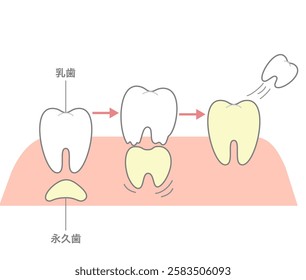 The process where permanent teeth push through and replace baby teeth by dissolving them.[Translate]Baby teeth,Baby teeth fall out