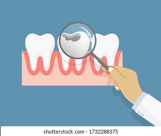 Professional dentist examines a bad tooth. Stamatologic concept. Vector illustration flat design. Isolated on background. Damaged tooth with a hole. Teeth examination dentistry concept.