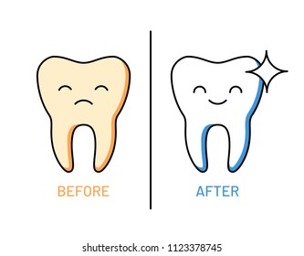 Professional teeth cleaning outline illustration. Whitening toothpaste advertising. Comic dental characters before and after cleaning. Modern stomatology assistance and oral hygiene vector concept