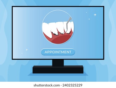 Ilustración vectorial de limpieza dental profesional. Descuento en la limpieza de dientes