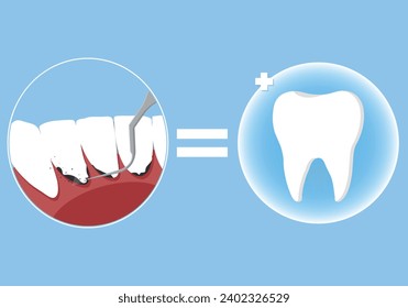 Ilustración vectorial de limpieza dental profesional. Reserve una cita para la limpieza de dientes