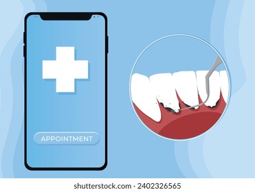 Ilustración vectorial de limpieza dental profesional. Reserve una cita para la limpieza de dientes