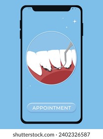 Ilustración vectorial de limpieza dental profesional. Reserve una cita para la limpieza de dientes