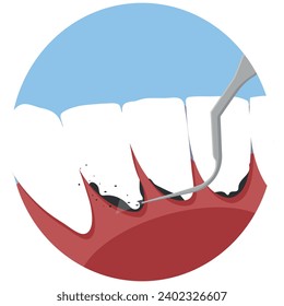 Ilustración vectorial de limpieza dental profesional. Reserve una cita para la limpieza de dientes