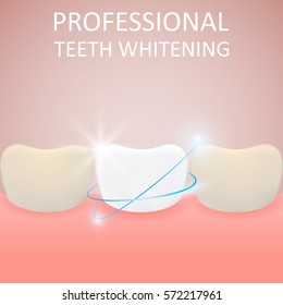 Professional Teeth Whitening, Healthy Tooth And Yellow Teeth, Vector Illustration