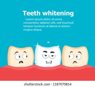 Professional teeth whitening vector illustration. Cosmetic dental care procedure. Comic dental characters before and after cleaning. Modern stomatology assistance and oral hygiene