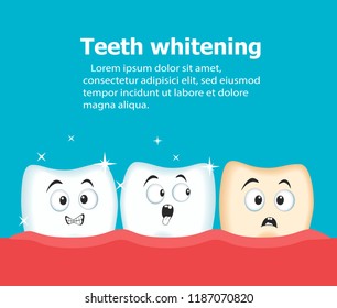 Professional teeth whitening vector illustration. Cosmetic dental care procedure. Comic dental characters before and after cleaning. Modern stomatology assistance and oral hygiene