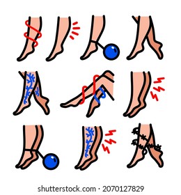 Professional vector set of varicose vein disease icons for medical and phlebology design. Covers symptoms, anatomy, and treatment methods. Ideal for clinics' educational materials, healthcare websites, and visual guides for patients.