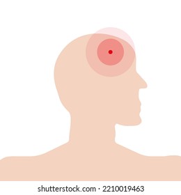 Profile, silhouette of a person's head with a schematic image of a headache, migraine