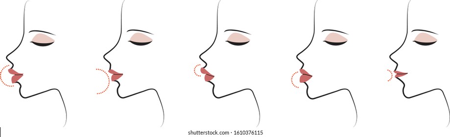 Profile Woman Lip Forms. Lips Shape. Vector Illustration. Isolated On A White Background