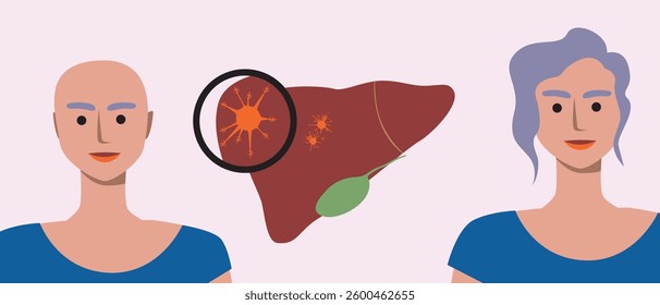 Progress before and after, liver cancer patient, flat vector stock illustration as oncology treatment concept