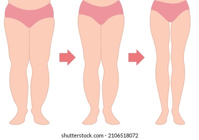 Progress of diet: thin legs