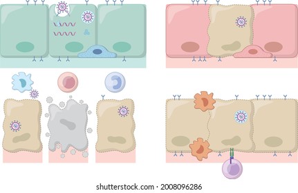 progreso de la infección y anticuerpos de patógenos