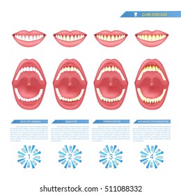 the progress of periodontal disease