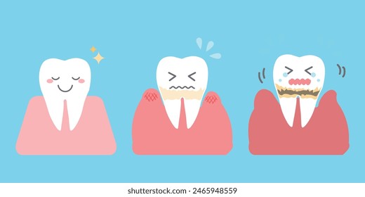 Progresión de la enfermedad periodontal Ilustración simple de los dientes