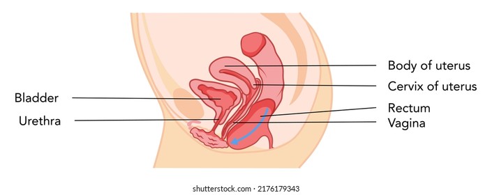 Prolapses Rectocele Female Reproductive System Uterus Diagram With Inscriptions. Side View In A Cut. Human Anatomy Internal Organs Flat Style Icon. Vector Medical Illustration Color Concept Isolated