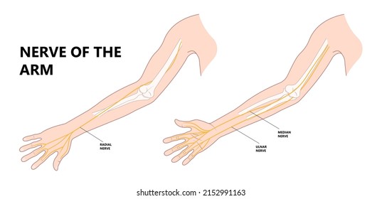 Pronator teres syndrome of nerve palsy carpal tunnel claw hand sport injury pain arm elbow joint ulnar wrist drop distal outlet neuropathies fall Radial motor tendon night Phalen test preacher papal