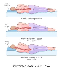 Posiciones de sueño laterales adecuadas e inadecuadas con alineación de la columna vertebral, los efectos de la altura de la almohada y el diagrama de firmeza del colchón Ilustración vectorial dibujada a mano. Ilustración educativa de ciencia médica