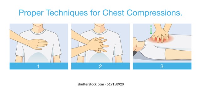 Proper techniques for chest compression. Illustration about emergency help and perform CPR. First aid for person has stopped breathing. 