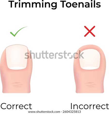 Proper Toenail Trimming Guide Correct vs Incorrect Vector Illustration