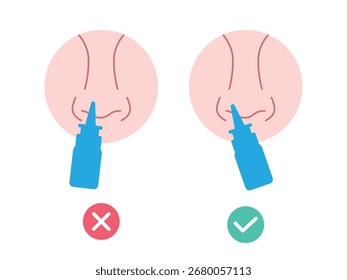 Uso adequado de um spray nasal