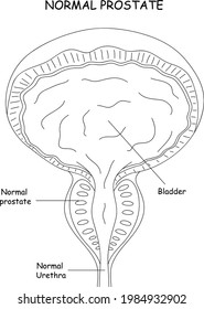 Prostate Anatomy Medical Illustration Simple Stock Vector (Royalty Free ...