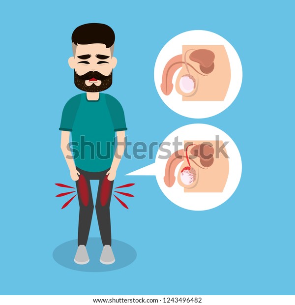 castigo de la leche de próstata