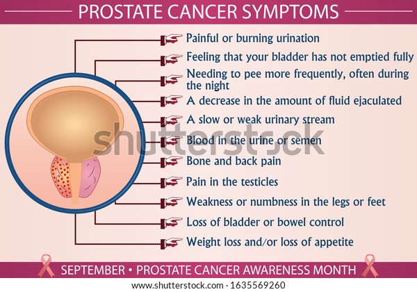 Prostate Cancer Disease Symptoms Infographic 600w 1635569260 
