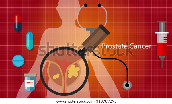 prueba gratuita de cáncer de próstata 2020 prueba gratuita de cáncer de próstata 2020