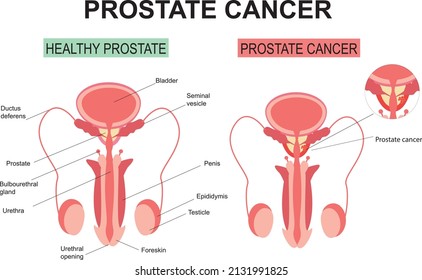 195,528 Reproductive Images, Stock Photos & Vectors | Shutterstock