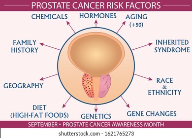 Prostate Cancer Risk Factor Infographic Vector Illustration. Health And Healthcare Concept Design For Presentation, Banner, Brochure, Etc. EPS-10 Vector, Printable Cmyk Colors.