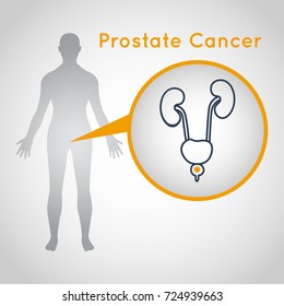 Prostate Cancer Vector Logo Icon Illustration