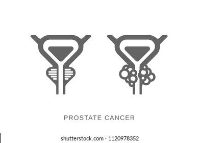 Prostate Gland Icon. Prostate Cancer Icon. Vector Flat Silhouette Scheme Of Prostate, Bladder And Cancer Tumor Isolated On Light Background. 