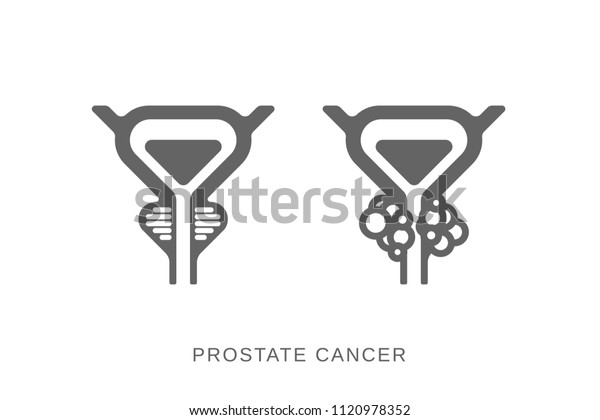 Prostate Gland Icon Prostate Cancer Icon Stock Vector (Royalty Free ...