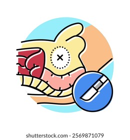 prostatectomy surgery hospital color icon vector. prostatectomy surgery hospital sign. isolated symbol illustration