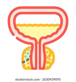 prostatectomy urology color icon vector. prostatectomy urology sign. isolated symbol illustration