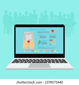 Prostatitis. Prostatic hyperplasia. Medical infographic set elements and symbols for design. Vector illustration