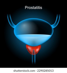 Prostatitis. Red Prostate gland and blue realistic bladder with glowing effect on dark background. Human urinary system. Part of male reproductive system. vector illustration like x-ray image. 